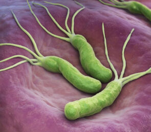 Helicobacter Pylori: Cauza ascunsa a tulburarilor digestive