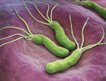 Helicobacter Pylori: Cauza ascunsa a tulburarilor digestive