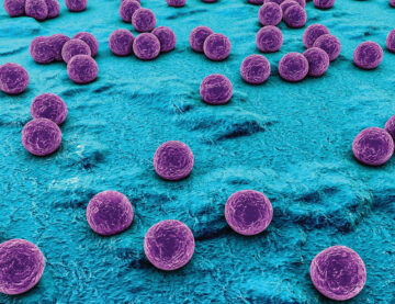 Staphylococcus aureus